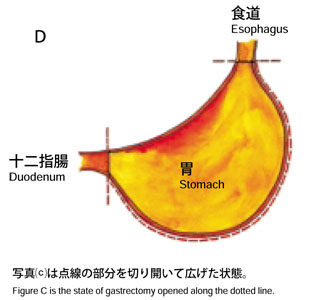 胃の模式図